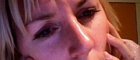 Laser therapy for rosacea