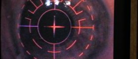 Lasik eye surgery pros and cons