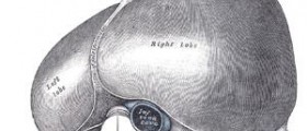 Liver failure treatment
