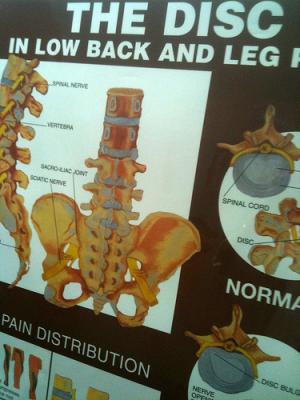 Lower back and hip pain