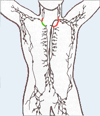 Lymphatic system diseases