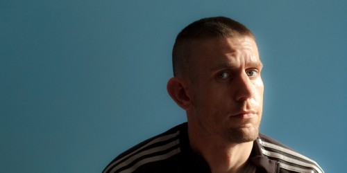 Hair Transplant Information: Is it Safe?