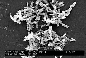 Management and prognosis of Clostridium difficile