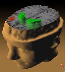Mental disorders: What is causing them?