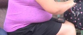 Morbid obesity - surgery for the morbidly obese