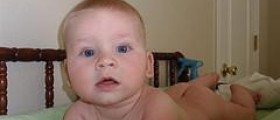 Most common rashes in children