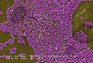 MRSA blood infection
