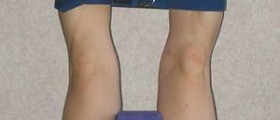 Muscle twitching in legs