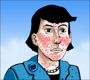 Natural acne medication tips