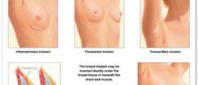 Natural breast enlargement secrets
