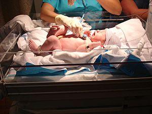 Newborn bowel movements