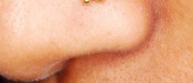 Nose piercing infection