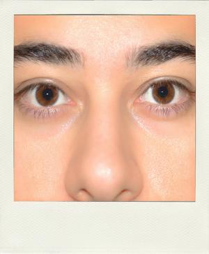 Oily face remedies