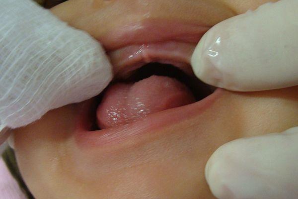 Oral health care in pediatric dentistry Colorado Springs