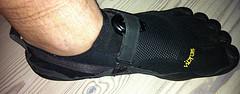Orthotics for plantar fasciitis