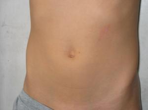 Pain behind belly button
