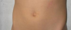 Pain behind belly button