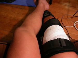Pain in medial knee