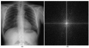 pain in middle of chest