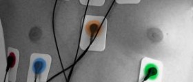 Pain in right side of chest