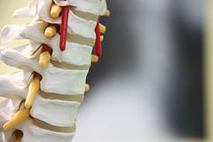 Pain management for spinal cord
