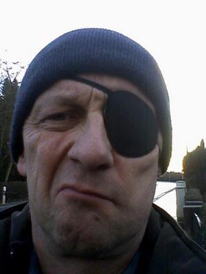 Paralysis of the face
