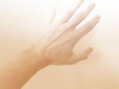 Peeling skin on fingertips