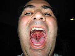 Phlegm in throat