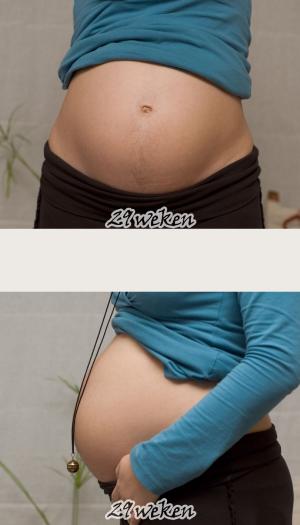 Physical signs of pregnancy