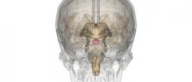 Pituitary disorders: About pituitary apoplexy