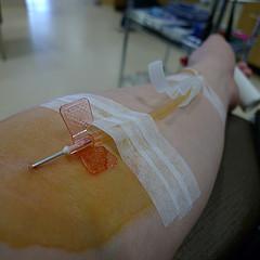 Plasmapheresis and autoimmune disease