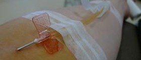 Plasmapheresis and autoimmune disease