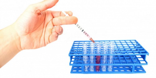 Experimental Aids Vaccine Shows Promising Results In Monkeys