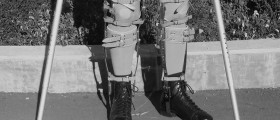 Polio or Poliomyelitis: Viral Paralytic Disease