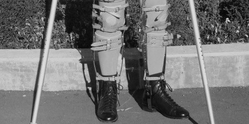 Polio or Poliomyelitis: Viral Paralytic Disease