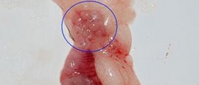Polycystic ovary syndrome - the problem and its solution
