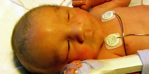 Alagille Syndrome: Causes, Symptoms, Treatment