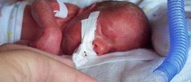 Premature babies facts