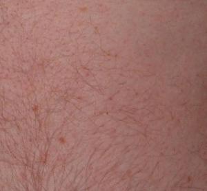 Prepare your skin for effective body hair removal