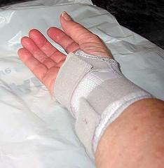 Prevention of carpal tunnel syndrome