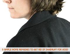 Prevention of dandruff