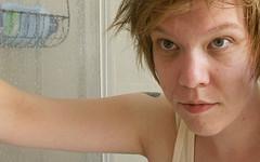 Prevention of dark circles