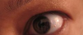 Prevention of eye strain