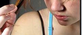 Prevention of grey hair