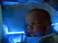 Prevention of haemolytic disease of the newborn