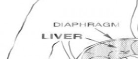 Prevention of hepatitis