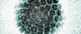 Prevention of human papillomavirus