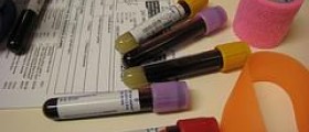 Prevention of hyperlipidemia