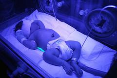 Prevention of jaundice during pregnancy