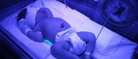 Prevention of jaundice during pregnancy